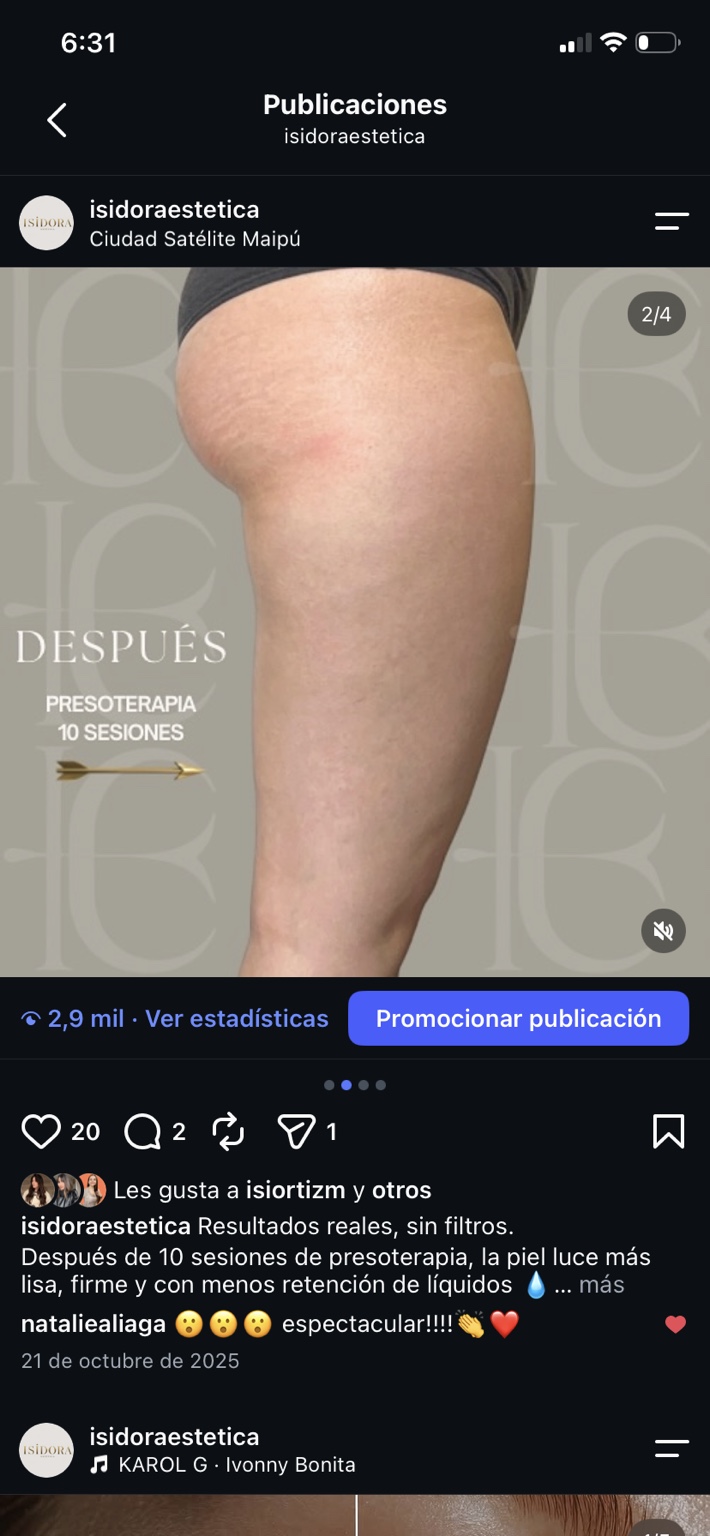 Después de 10 sesiones de presoterapia, comparación 1.